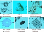 Fig. 1. Non-pollen microfossils viewed under a optical microscope at magnification of 400x. Photo A. Pedziszewska , M. Zimny and J. Święta-Musznicka.