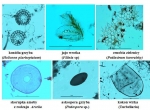 Fot. 1. Mikrofosylia pozapyłkowe widziane w mikroskopie świetlnym przy powiększeniu 400x. Fot. A. Pedziszewska , M. Zimny i J. Święta-Musznicka