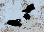 Fig. 1. Microscopic charcoal in a pollen sample. Photo A. Pędziszewska.