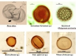 Fig. 1. Pollen grains seen under an optical microscope magnified 400x. Photo A. Pędziszewska and M. Zimny.