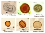 Ziarna pyłku widziane w mikroskopie świetlnym przy powiększeniu 400x. Fot. A. Pędziszewska i M. Zimny